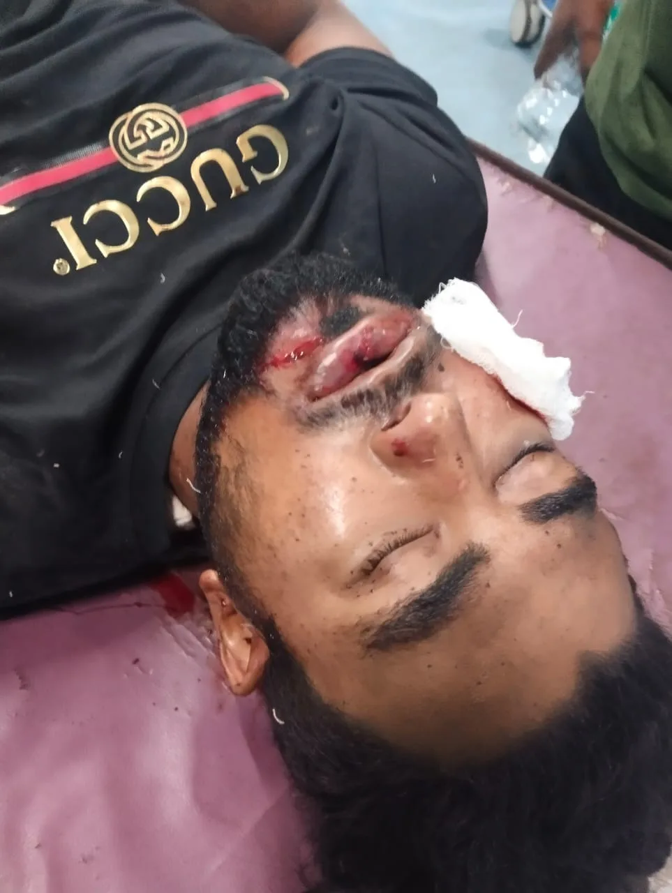 बेकसूर पिता बेटे और बेटे के दोस्त को चाकू से किया हमला तीनों की हालत गंभीर रिम्स भी ईलाज चल रहा