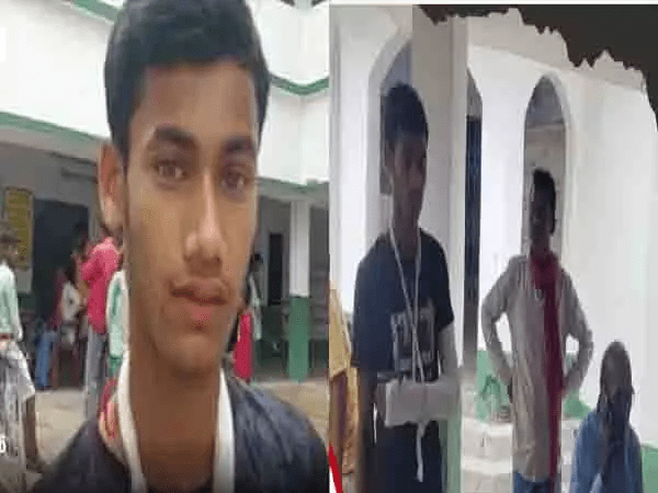 कक्षा 8 के छात्र का हाथ प्रिसिंपल ने तोड़ा
