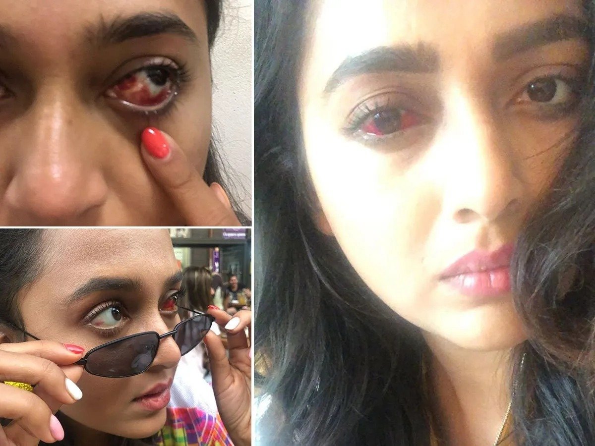 तेजस्वी प्रकाश के स्टंट करते समय हुआ गंभीर दुर्घटना