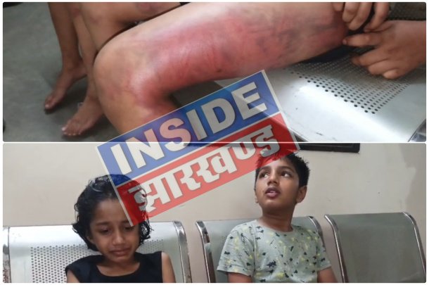Jamshedpur : जुगसलाई में ट्यूशन टीचर की हैवानियत, कम नंबर आने पर मासूम भाई-बहन को बेरहमी से पीटा; उंगली टूटी