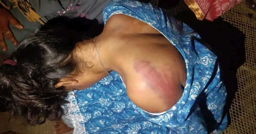 Seraikela News : सरायकेला में आदिवासी युवती से हिंसा मामले में बड़ी कार्रवाई, कपाली ओपी प्रभारी समेत तीन पुलिसकर्मी निलंबित